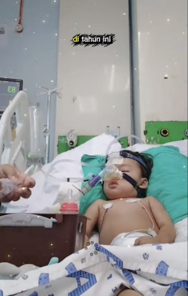 jangkitan influenza A